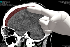 Skull+Hand-240x160